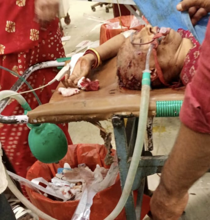 करवा चौथ पर पति ने पत्नी पर कुल्हाड़ी से किया हमला, हालत गंभीर